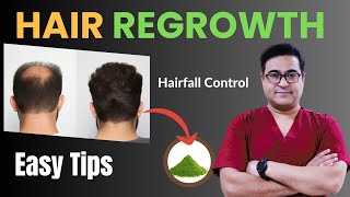 Guaranteed Hair Regrowth Tips by Dr Vikram  hairregrowth hairfall [upl. by Garap]