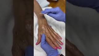 Hand Peel Video [upl. by Bilak]