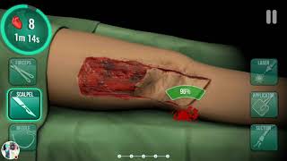 Gaping Wound in my new hospital My Operate Now Hospital Stream [upl. by Biernat106]