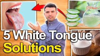 5 White Tongue Causes and Natural Treatments [upl. by Idel378]