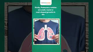 Understanding Pulmonary Nodules Causes Symptoms and More  Horizon Hospitals [upl. by Asiruam]