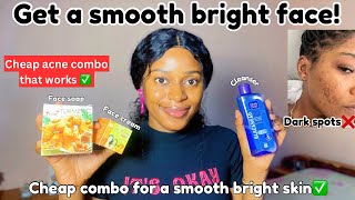 Clear your dark spots and get a smooth bright skin with just 3 cheap products  acne treatment combo [upl. by Eirrak]