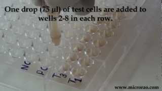 Treponema Pallidum Hemagglutination TPHA test for syphilis [upl. by Caddric35]