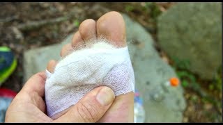 Blister Prevention on the Trail [upl. by Akimak570]