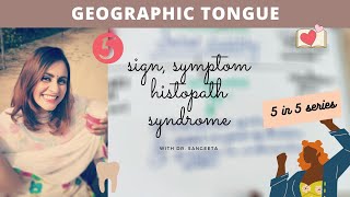 geographic tongue [upl. by Bozuwa]