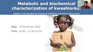 Revisiting the Evidence on Kwashiorkor Metabolic and Biochemical Characterization of Kwashiorkor [upl. by Zitah]