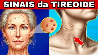 🚨 8 SINAIS de ALERTA da TIREOIDE Hipotireoidismo e Hipertireoidismo [upl. by Anisah688]