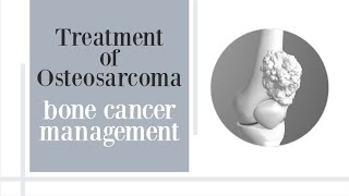 treatment of osteosarcoma [upl. by King89]