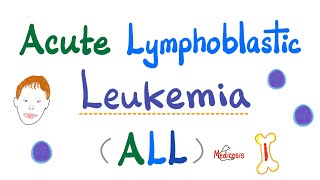 Acute Lymphoblastic Leukemia ALL  Symptoms Pathogenesis Diagnosis  Down Syndrome  Hematology [upl. by Ledif]