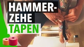 Hammerzehe Tapen Anleitung  Hammerzeh Kinesiology Tape Anleitung  Selbst Zeh Tapen [upl. by Zeitler]