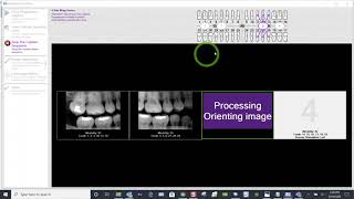 Training Apteryx XVWeb 20  How to Acquire 4 BWXs in XVCapture [upl. by Lugo]