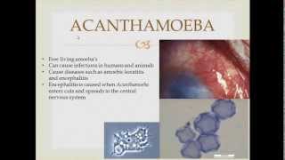 Parasitology Acanthamoeba [upl. by Aaren19]