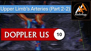 10  Upper Limbs Arteries Part 22 [upl. by Aeiram]