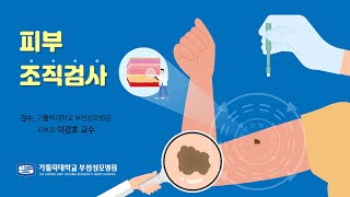 부천성모병원 피부 조직검사 검사방법 소독방법 주의사항 안내 [upl. by Adley]