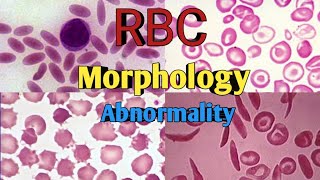 RBC Morphology  Anisocytosis Poikilocytosis  RBC shape amp Size Abnormality [upl. by Carolan]