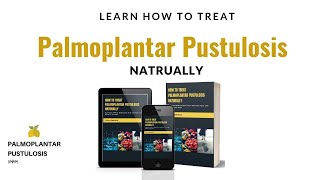 How To Treat Palmoplantar Pustulosis PPP Naturally [upl. by Quince]