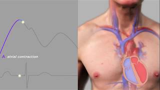 Easy Measurement of Jugular Venous Pressure [upl. by Nimad685]