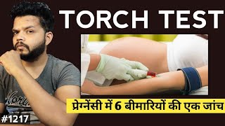 Torch Test Kya Hota Hai Kyon Or Kaise Kiya Jata Hai  Torch Test Explained In Hindi [upl. by Eibot339]