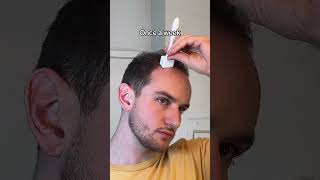 Derma stamp for saving hair line hairgrowth hairtransformation dermastamp dermaroller [upl. by Dnalro]