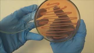 Microbiologia do solo isolamento de rizóbios [upl. by Peggir]