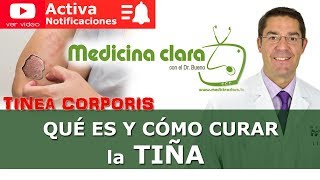 Tiña ¿como curar la tiña Síntomas tratamiento explicación  Medicina Clara [upl. by Idnahc]