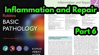 Arachidonic Acid metabolites Robbins pathologyProstaglandins and LeukotrienesInflammatory Mediator [upl. by Townie675]