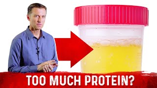 Top 5 Symptoms Of Eating Too Much Protein – DrBerg [upl. by Jaimie379]