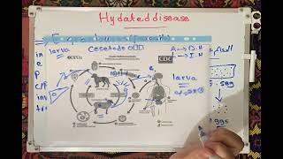 Hydatid Disease Life Cycle [upl. by Innavoij]