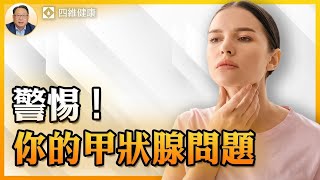 身體出現這些症狀？可能是你的甲狀腺出問題了！怎樣早預防？ [upl. by Eiralav43]