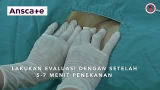 ANSCARE PAD  PENGGUNAAN PADA FEMORAL REMOVAL SHEATH [upl. by Ater]