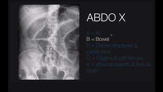 Abdominal xrays [upl. by Javler]