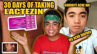 30 DAYS OF TAKING LACTEZIN HONEST REVIEW  SOLUSYON SA PIMPLES ACNE amp SEVERE ACNE [upl. by Nev290]