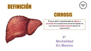 CIRROSIS Y COMPLICACIONES  ENARM  MEDICINA INTERNA [upl. by Qooraf955]