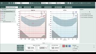 Stenger Test in Auditdata Measure [upl. by Assira803]