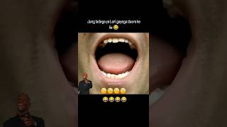 🥺🧐🧐 Attention 🧐🧐🥺 shorts motivation motivationalquotes trendingreels comedyshorts funnycomedy [upl. by Lehcar]