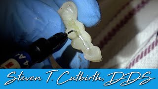 Reinforcing Long Span Provisional Bridge  Dental Minute with Steven T Cutbirth DDS [upl. by Nereids]