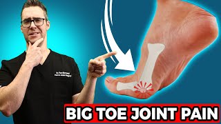 BEST Sesamoiditis Treatment Big Toe Joint Pain amp Big Toe Treatment [upl. by Nnyllaf499]