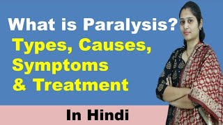 Paralysis  Causes Types symptoms  Paralysis meaning  In Hindi [upl. by Inglis]