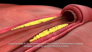 Lactobacillus plantarum INDUCIA [upl. by Vanzant]