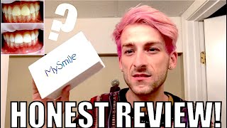 MYSMILE TEETH WHITENING SYSTEM  AN HONEST REVIEW [upl. by Scoville875]