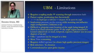 Ocular Imaging Ultrasound Biomicroscopy vs Anterior Segment OCT [upl. by Allianora]