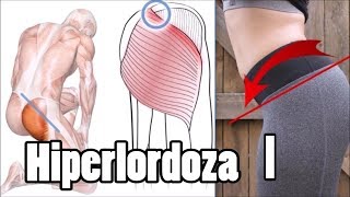 Pogłębiona lordoza lędźwiowa ból pleców  JAK SKORYGOWAĆ cz1 Anatomia [upl. by Yelsehc]