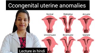 Uterine anomalies lecture in hindi  all about uterine anomalies [upl. by Heall94]