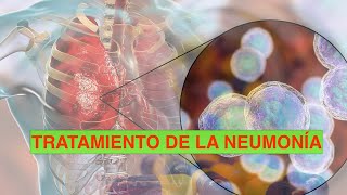 Tratamiento empirico de la Neumonia ¿Qué antibiótico usar [upl. by Annor]