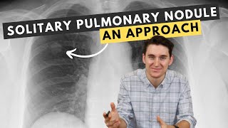 My approach to solitary pulmonary nodules [upl. by Aiceled]