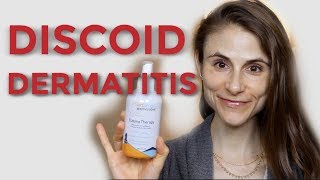 DISCOID NUMMULAR DERMATITIS TIPS FROM A DERMATOLOGIST DR DRAY [upl. by Eaneg]