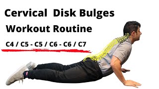 Workout routine for Cervical Disc Bulges  Beginner Level [upl. by Ailina]