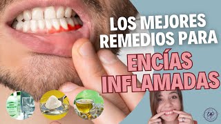 Cual es el MEJOR REMEDIO para las ENCÍAS INFLAMADAS en 2023 ✅🦷 [upl. by Penelopa]