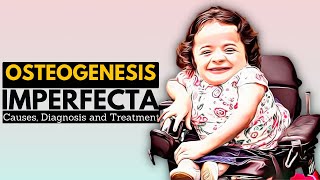 OSTEOGENESIS IMPERFECTA OI Causes Signs and Symptoms Diagnosis and Treatment [upl. by Micro]