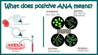 Antinuclear Antibodies ANA test and their patterns  ANA test  What does ANA test positive mean [upl. by Kyte]